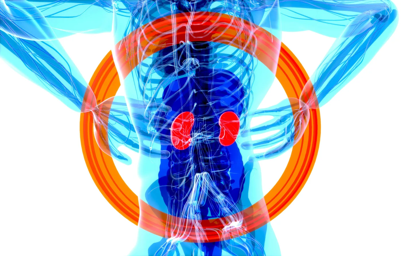 Calcium oxalate stones account for roughly 80% of all kidney stone cases. Researchers in a 2025 clinical study analyzed 24-hour urine samples from 98 patients one month after surgical removal to map the full chemistry behind recurrence. Image credit: MDPI / Diagnostics, 2025.